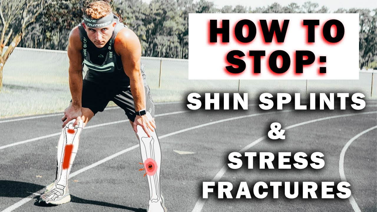 How to Prevent Shin Splints and Stress Fractures