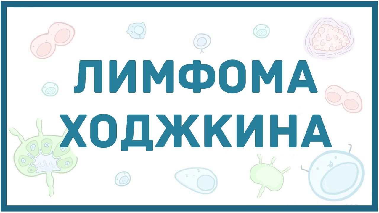 Лимфома Ходжкина - виды, причины, патогенез