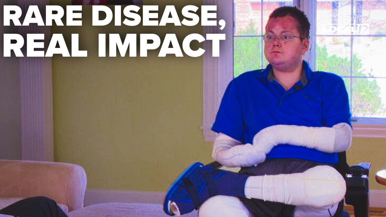 Жительница Огайо, пережившая «синдром бабочки», помогает людям с редким генетическим заболеванием.