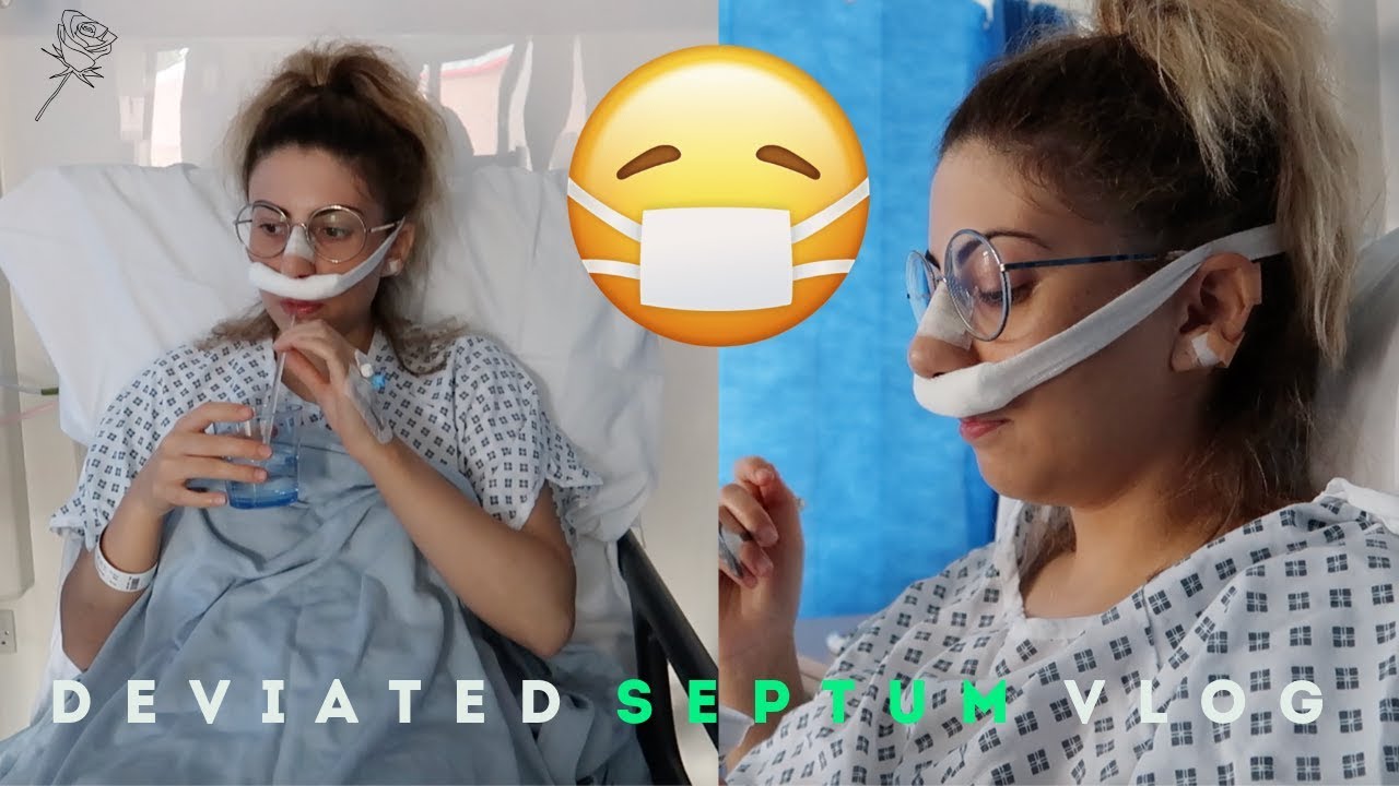 I GOT NOSE SURGERY?! DEVIATED SEPTUM VLOG, EXPERIENCE & ADVICE