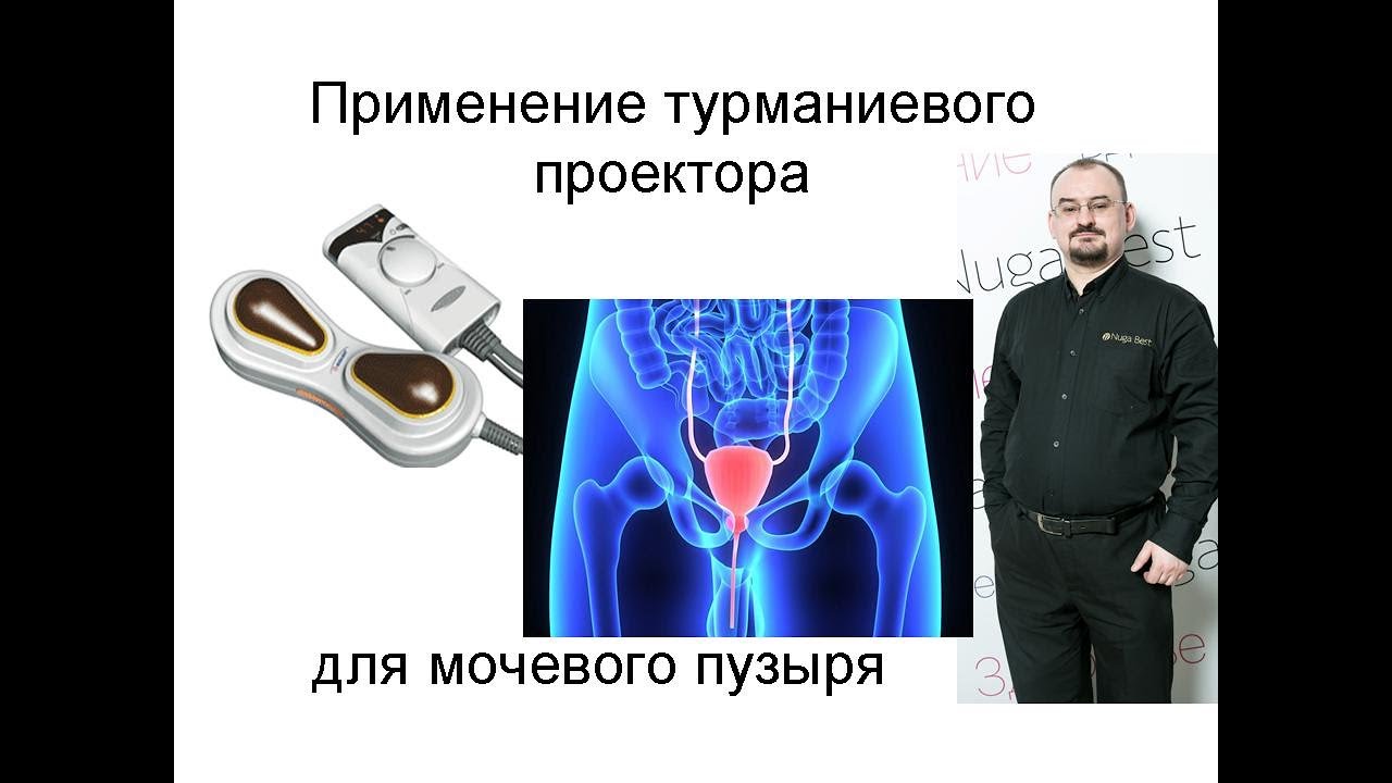 Применение турманиевого проектора для мочевого пузыря.