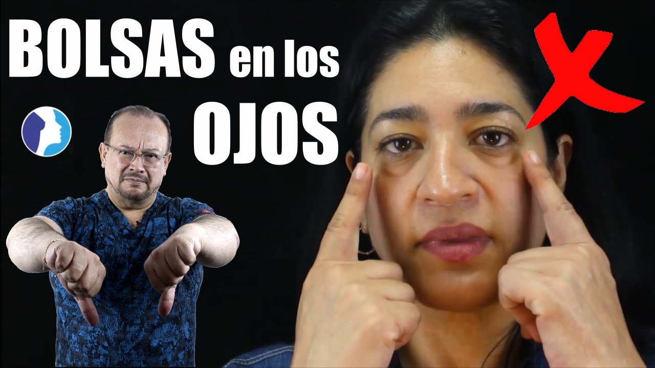 BLEFAROPLASTÍA para REJUVENECER la MIRADA 👀 Bolsa en PÁRPADOS 👀 CASO REAL 🤩 DR ALBERTO CALVO