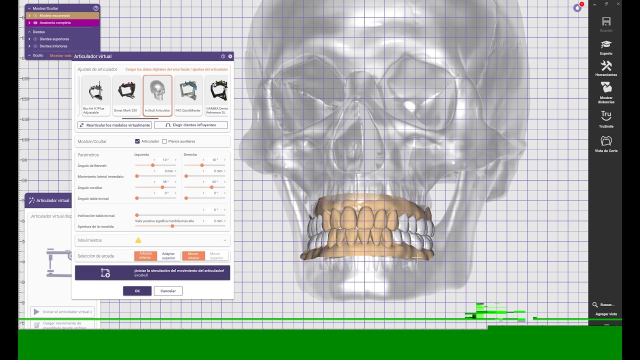 🦷 ExoCAD 3.3 Chemnitz 9512 🦷