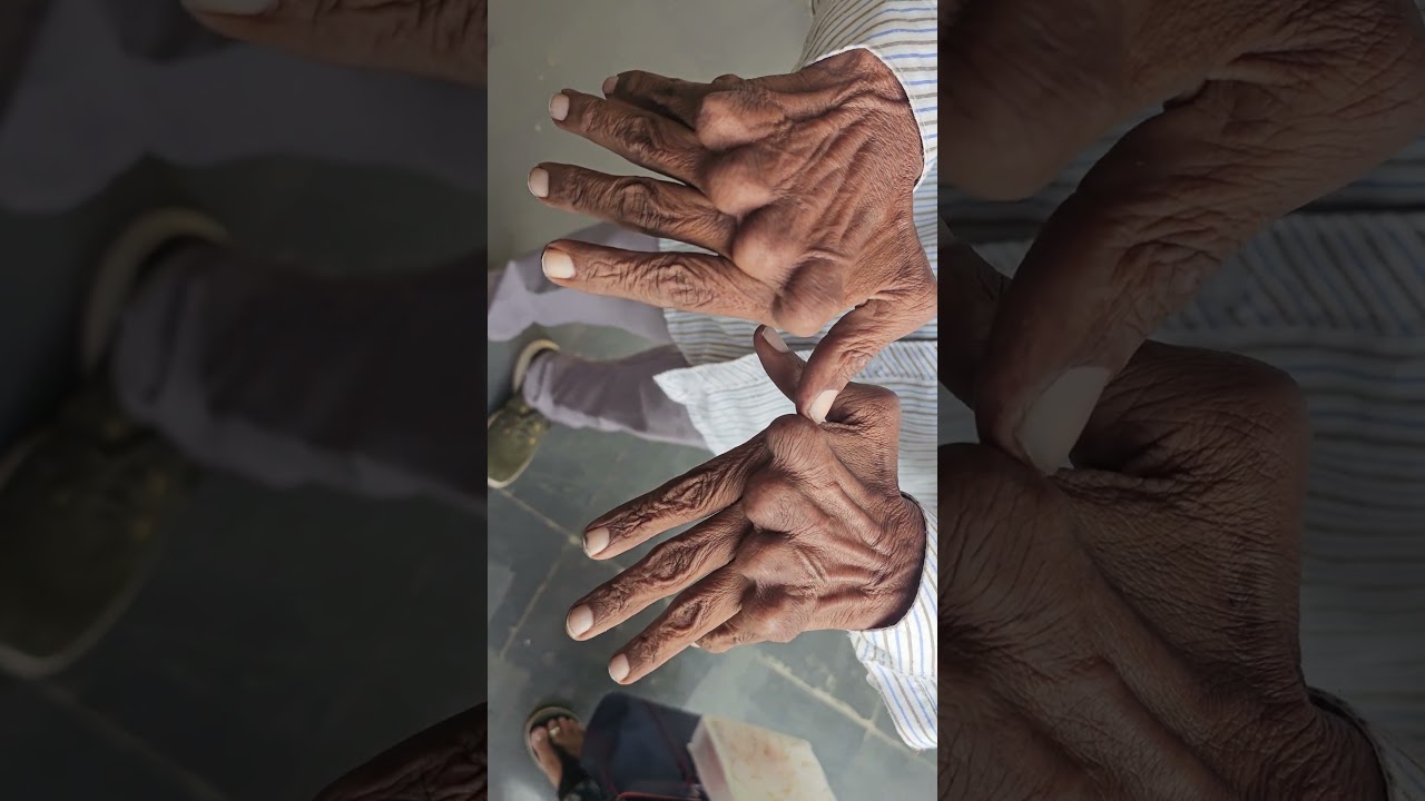 Spot Diagnosis 