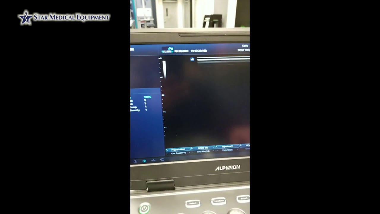 Alpinion Ecube i7 Focus and Depth