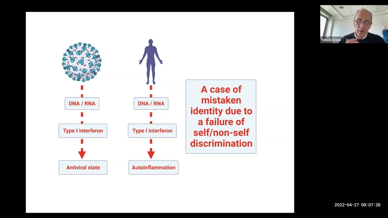 Human type I interferonopathies by Dr. Yanick Crow