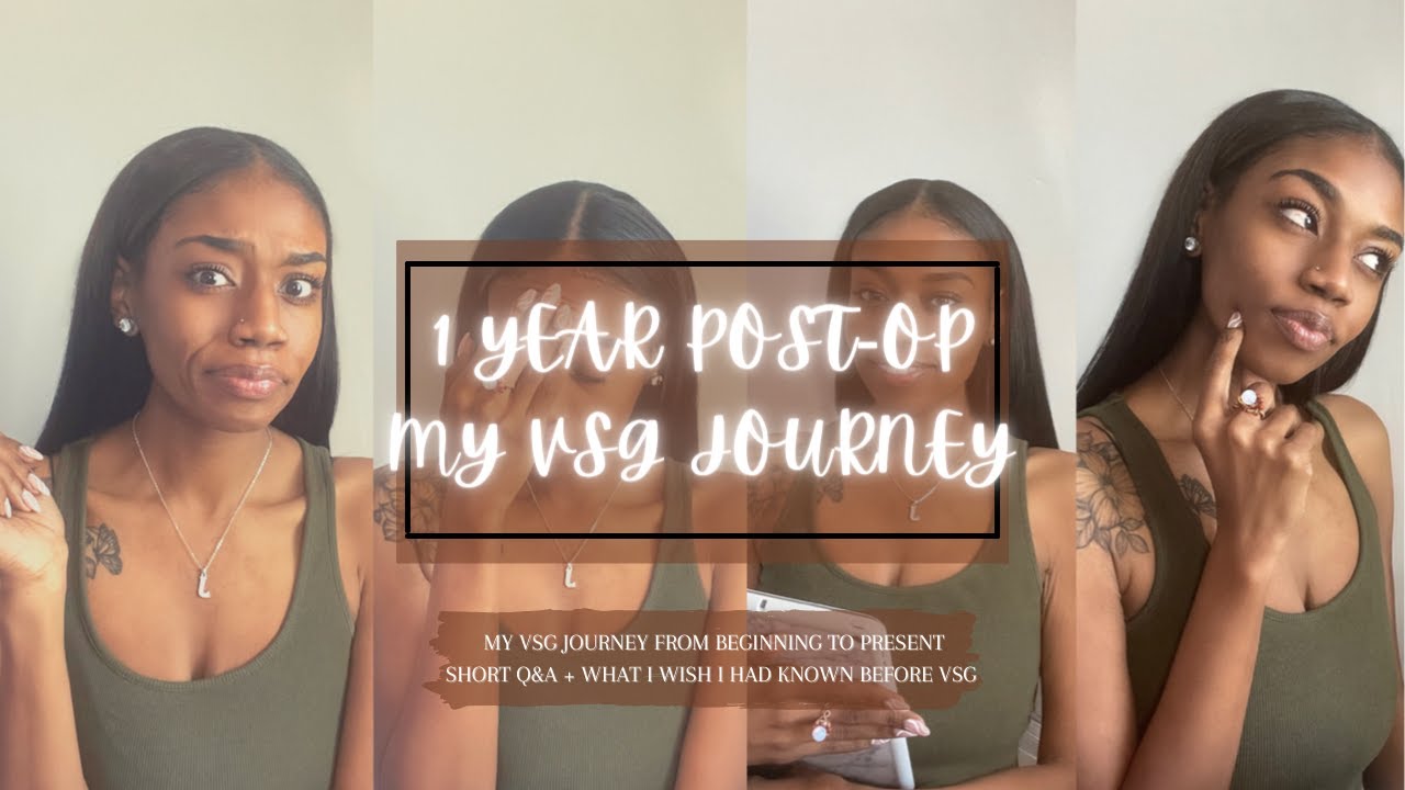 VSG Journey | 1 Year Post-Op, Before and After, My Weight Loss Transformation, VSG Story Time