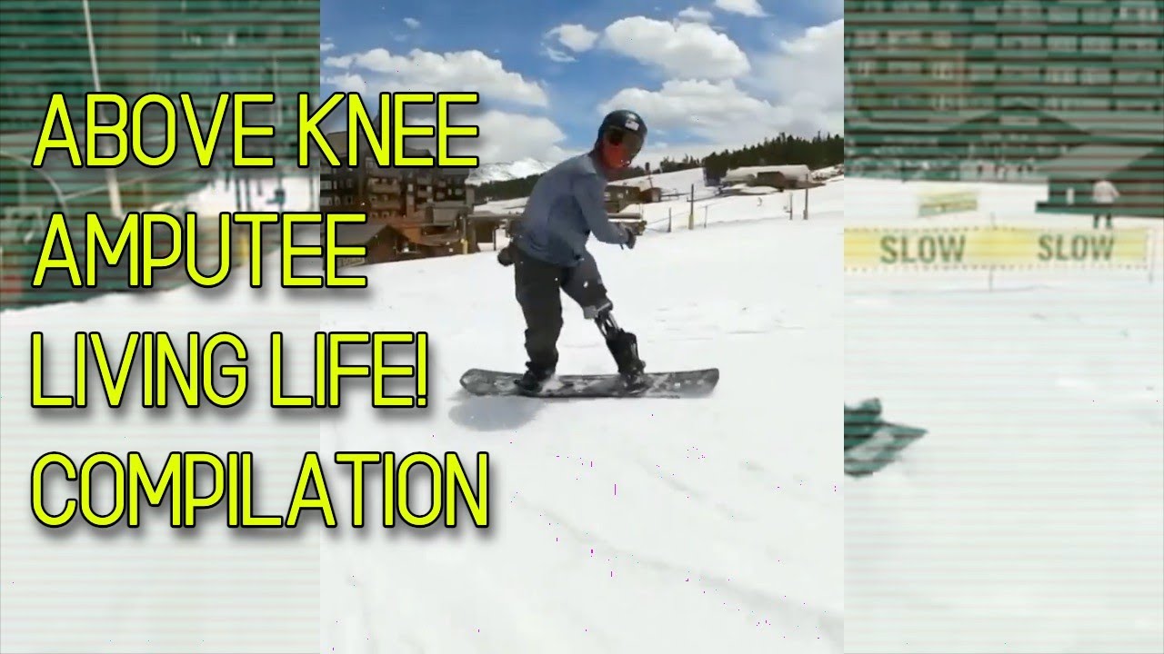 Above Knee Amputees LIVING LIFE! Compilation 🦿 🔥
