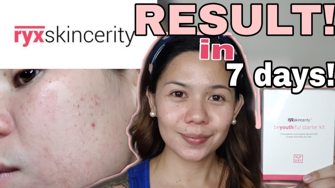 RYX SKINCERITY STARTER KIT! HONEST REVIEW!