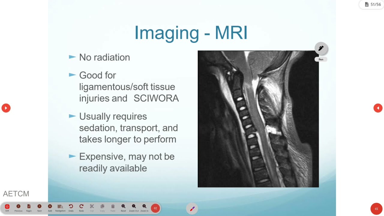 Pediatric Trauma Assessment and Resuscitation Part 2 || AETCM # Emergency Medicine