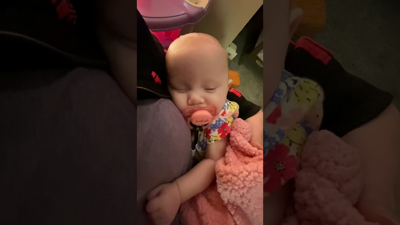 Beginning of baby infant seizure infantile spasm