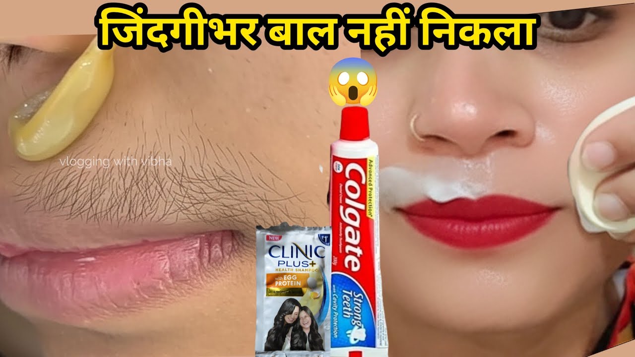 डॉक्टर ने बताया👉बिना किसी दर्द चेहरे के बाल हटाने का ये दो बूंद लगते ही हैरान हूं😱|| facial hair