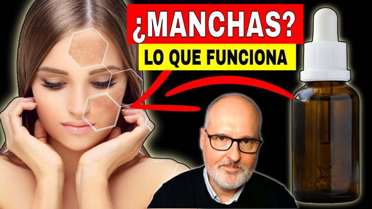 MELASMA: Lo Que Nadie Te Explica Sobre Cómo Reducir Manchas en la Cara