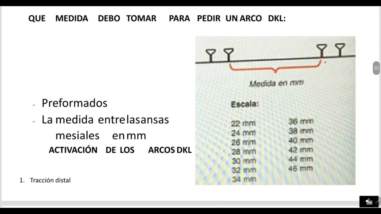 ARCOS DKL en ortodoncia (double key loop)