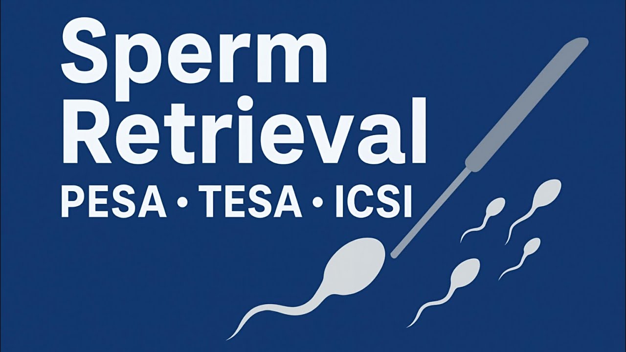 Как работает процедура извлечения сперматозоидов: PESA, TESA и ICSI.