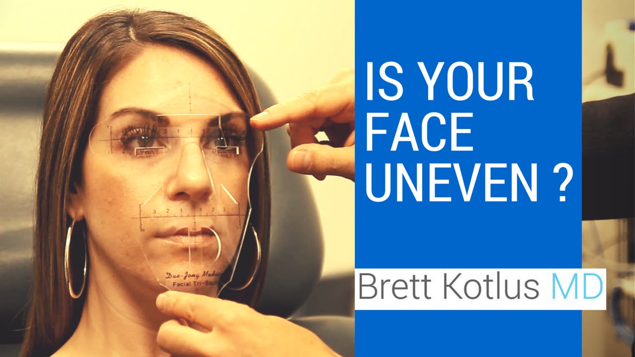 Facial symmetry and asymmetry