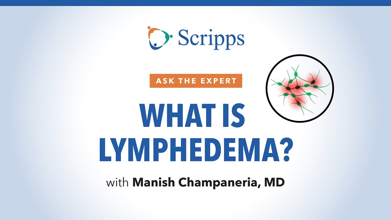 What Is Lymphedema and How Is It Treated? | Ask The Expert
