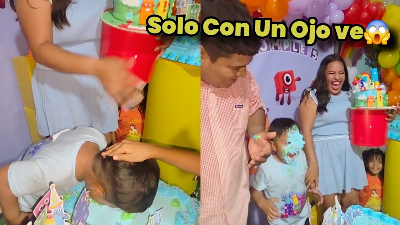Dios Mio Como Dejaron a Mi Hijo😱Toda la Cara le Metieron 