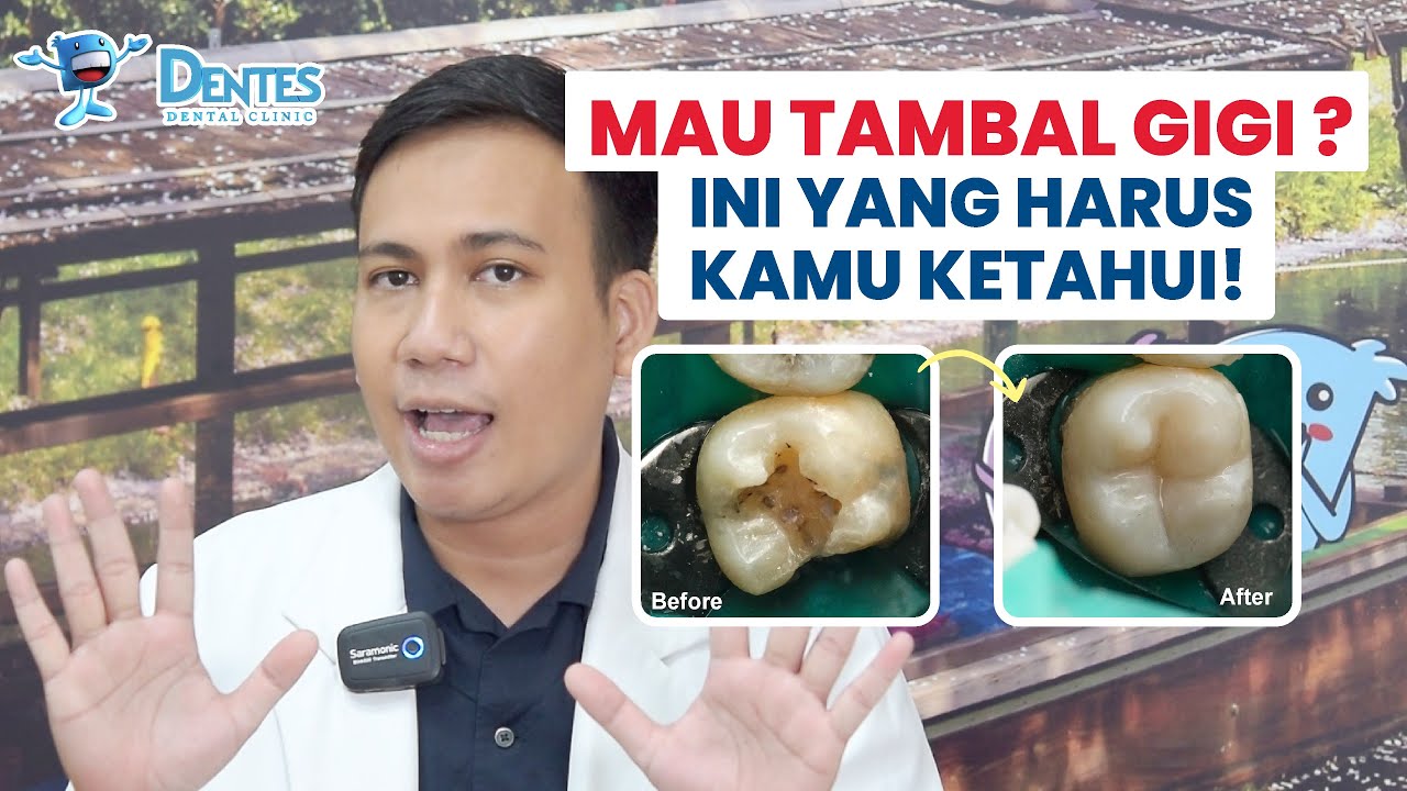 Kupas Tuntas Tentang Penambalan Gigi