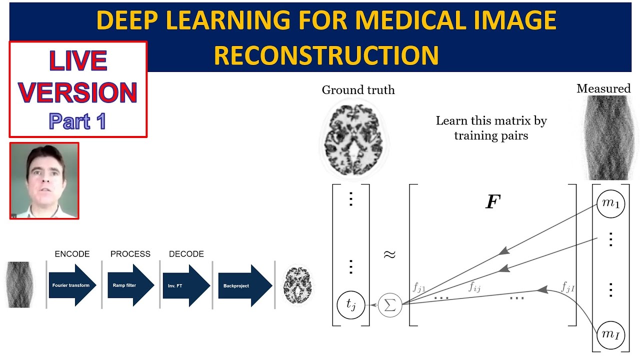 Pt 1: Brief Reconstruction Review and Machine Learning Approach, Linear Model and FBP