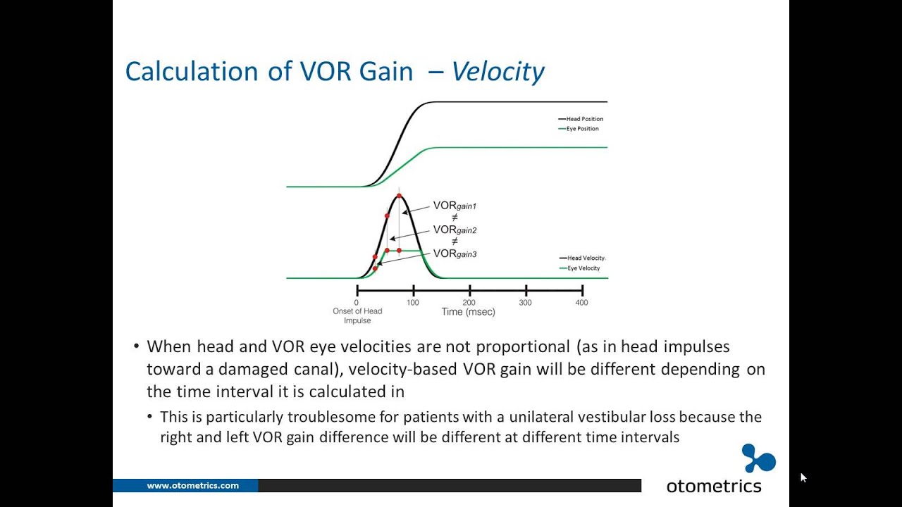 ICS Impulse vHIT: Interpretation of test results