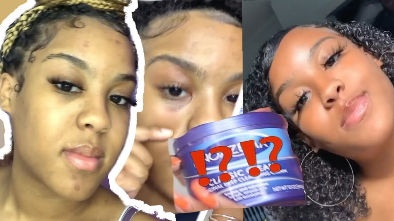 My Skin Routine😫 ! (how i got rid of dark spots)