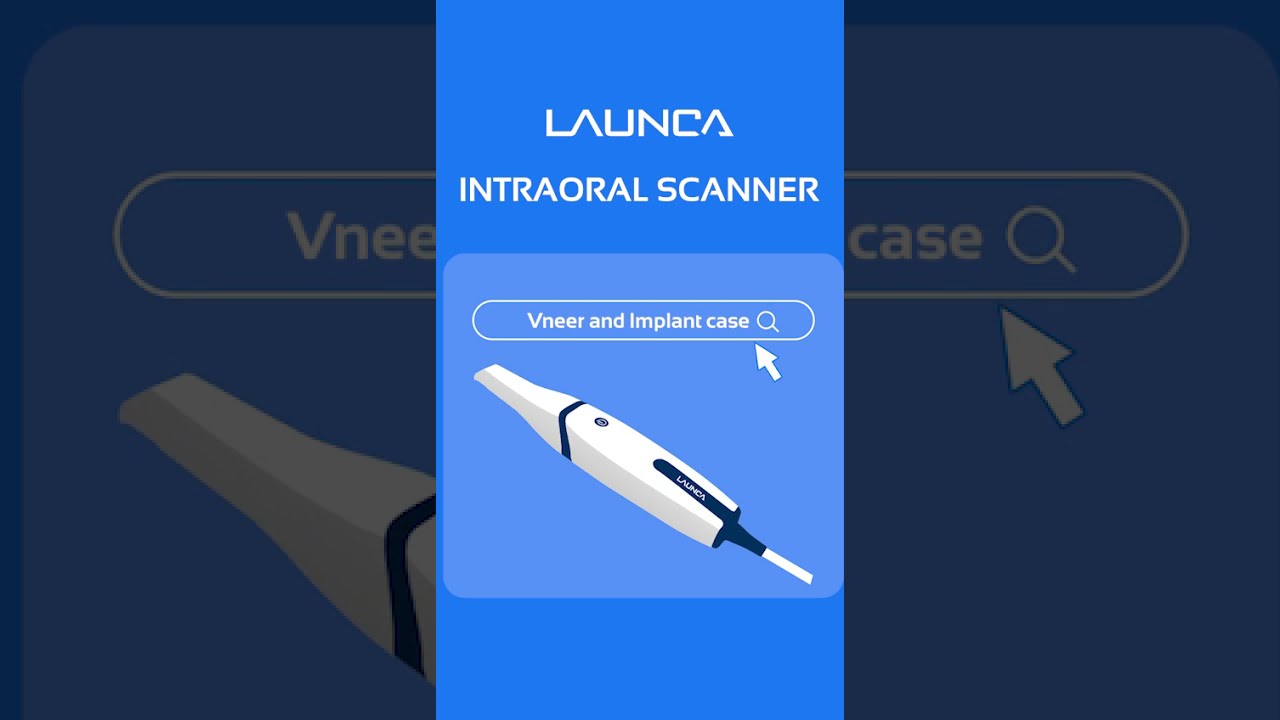 Launca intraoral scanning venner and implant case by Dr. Fabio Oliveira
