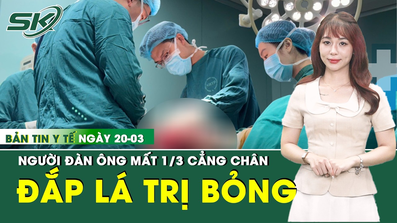 Bản Tin Y Tế 20/3: Người đàn ông phải cắt cụt 1/3 cẳng chân sau khi tự đắp lá điều trị vết bỏng