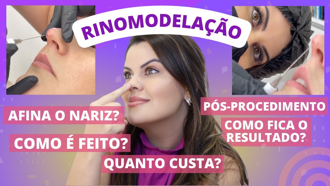 RINOMODELAÇÃO | Transformando o nariz SEM CORTES! Respondendo dúvidas.