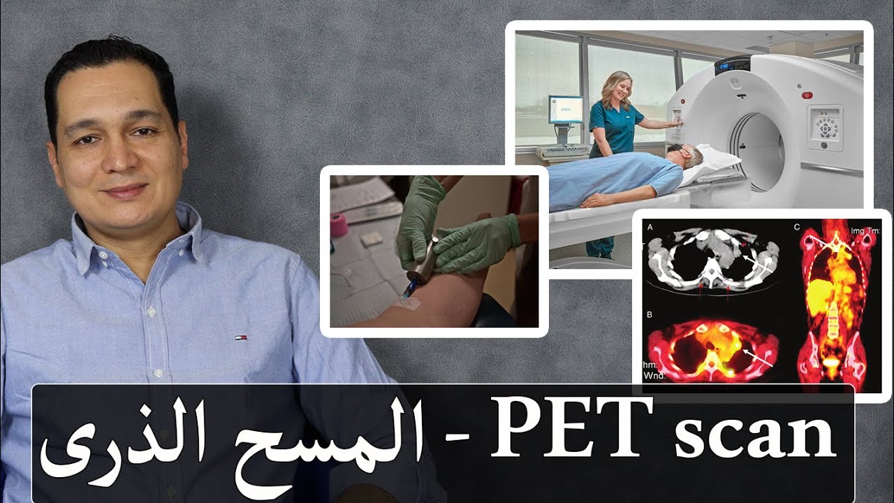 المسح الذرى على الجسم / PET scan