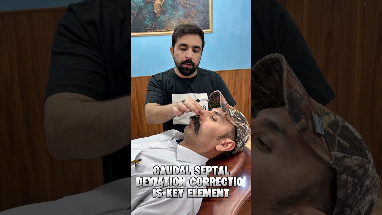 Understanding patient goals in rhinoplasty #rhino