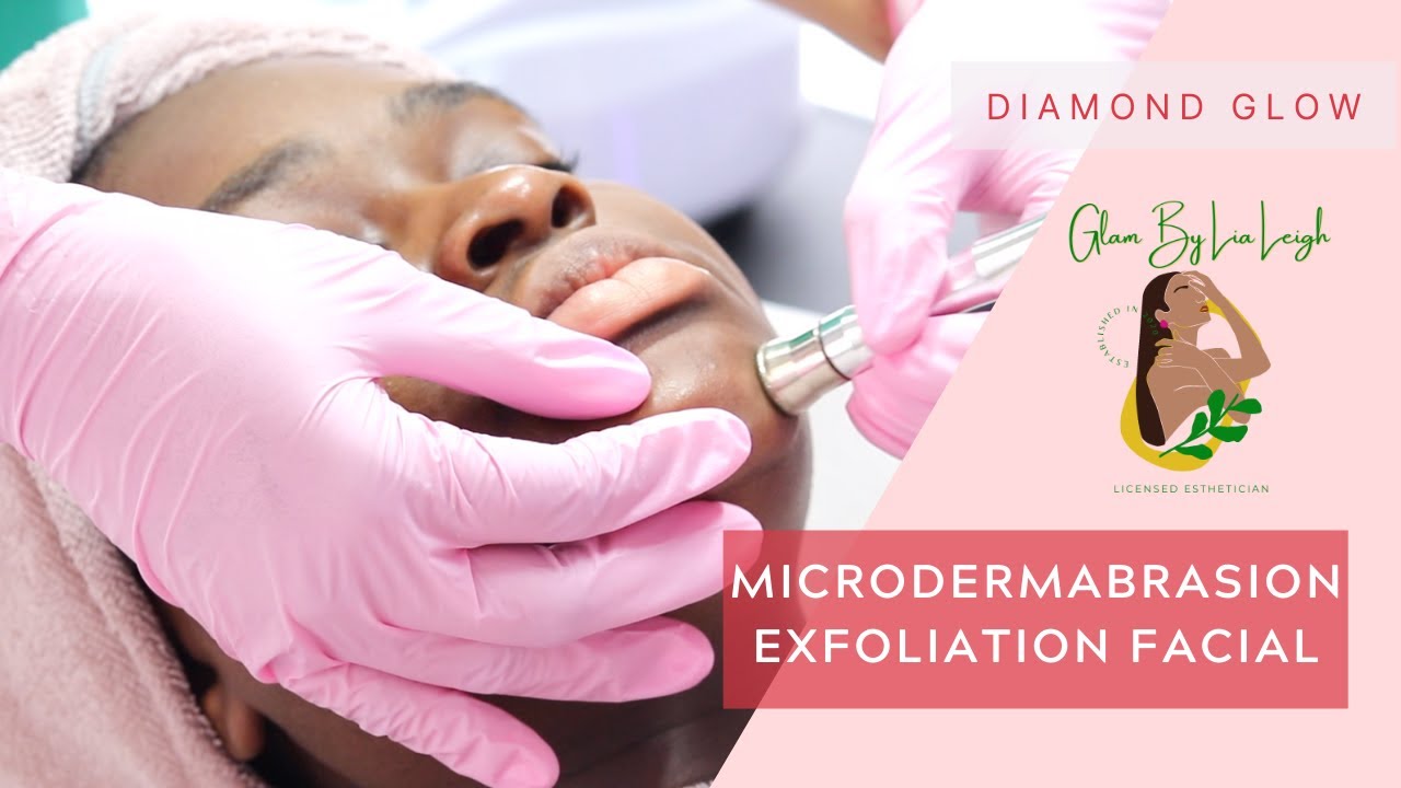 Get A Microdermabrasion Facial with Me | Glam By LiaLeigh