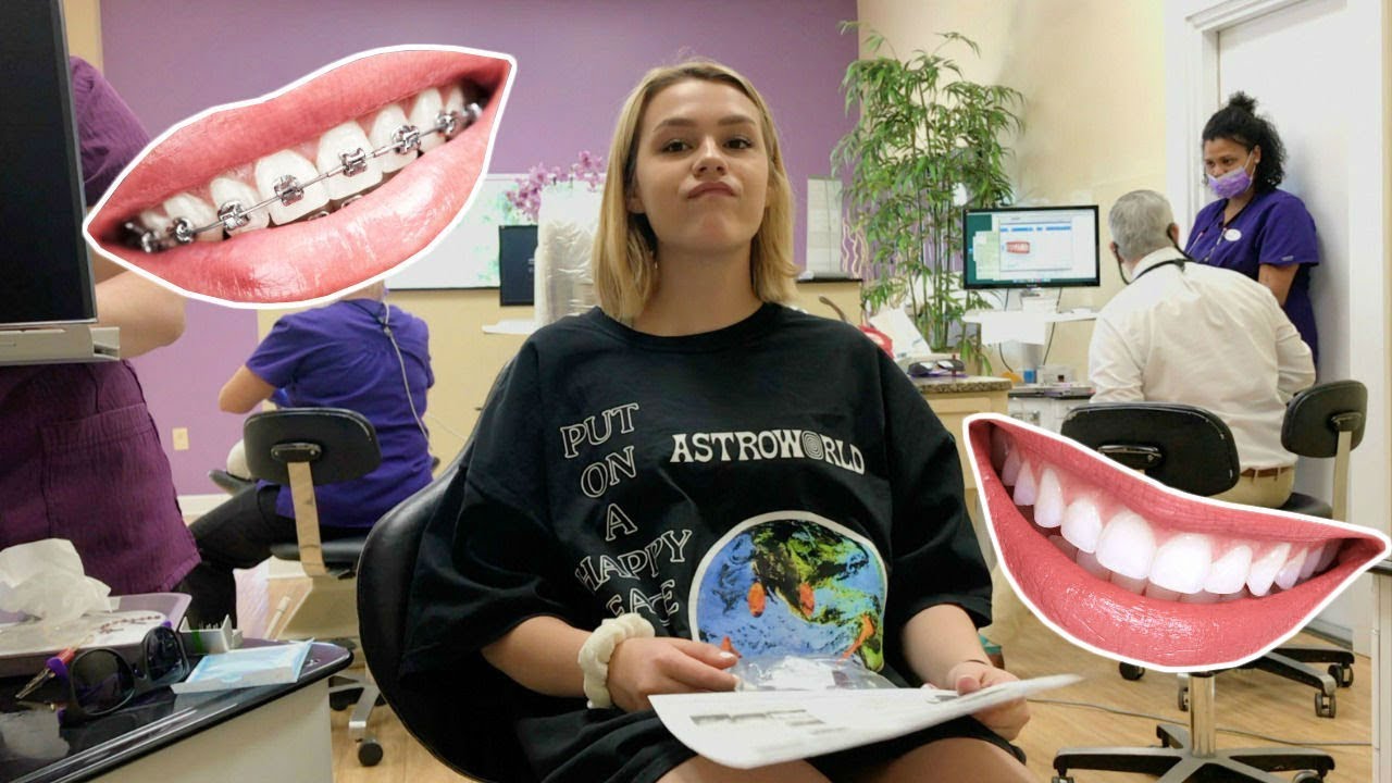 getting my braces off