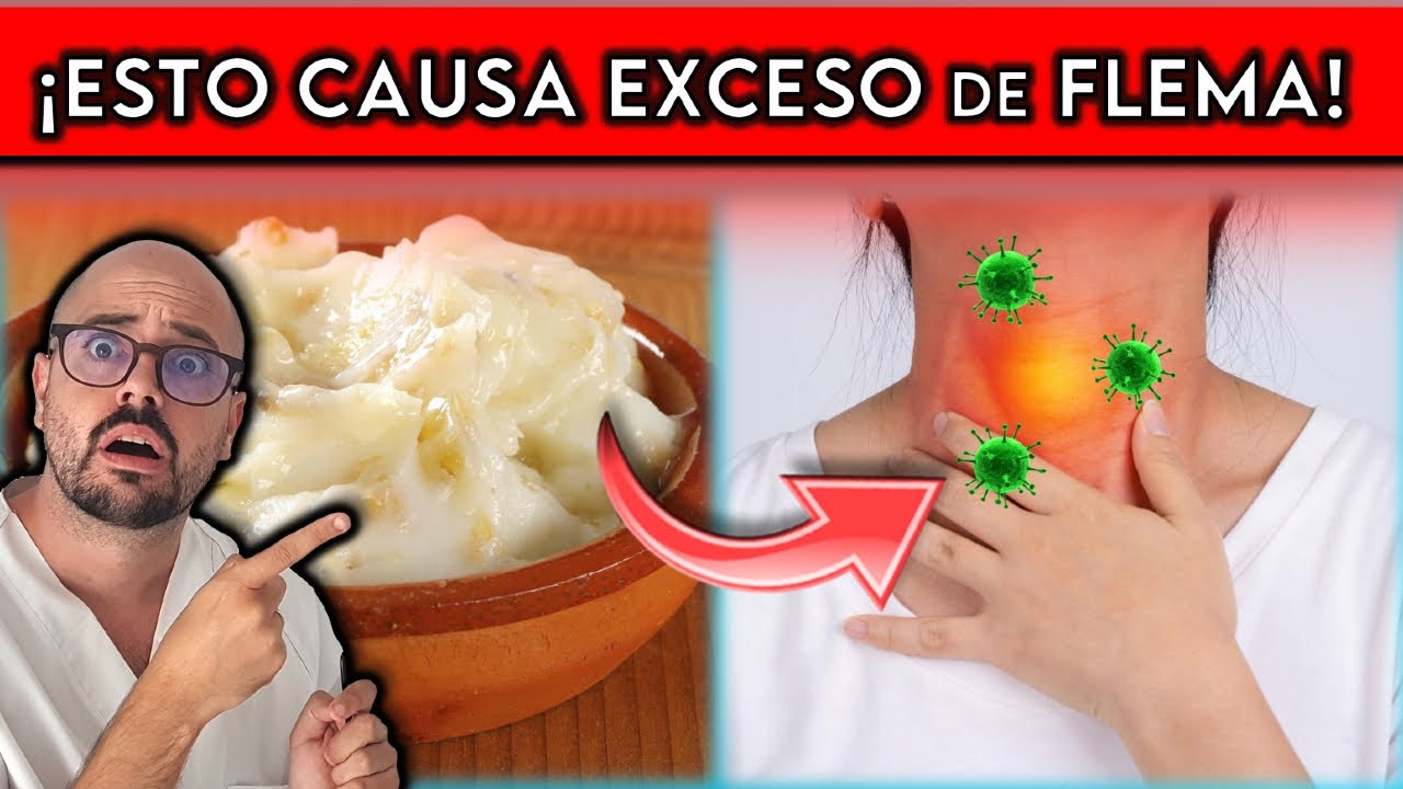 5 ALIMENTOS que causan MOCO y FLEMA EN LA GARGANTA || &iexcl;REMEDIOS para eliminar MOCOS!
