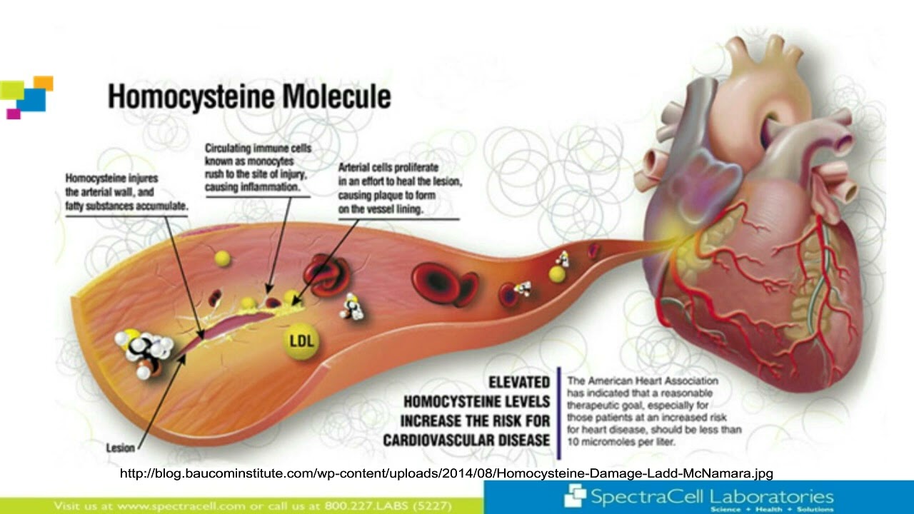 Homocysteine A Marker for Neuroinflammation