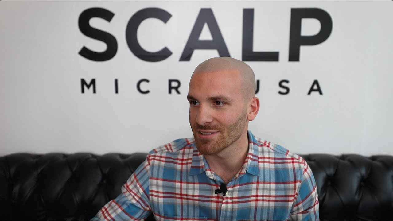 Matt’s AWESOME Scalp Micropigmentation Transformation | Scalp Micro USA