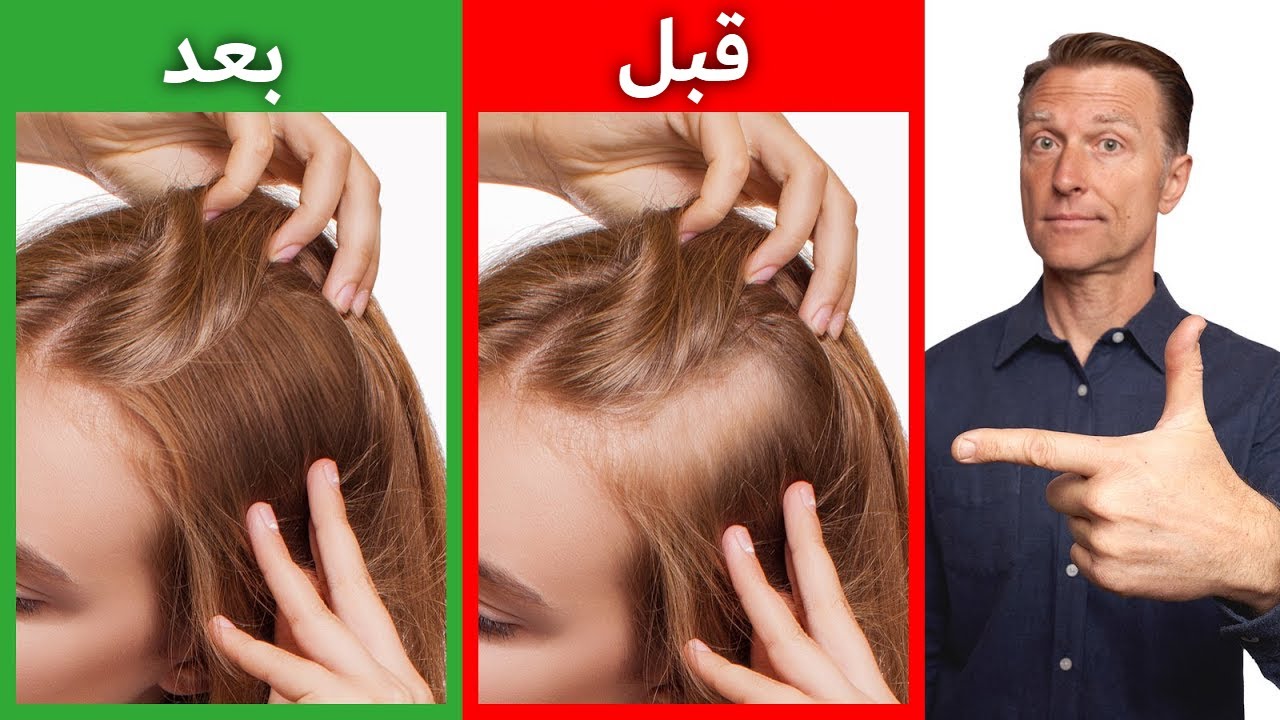كيفية زيادة كثافة الشعر بشكل طبيعي