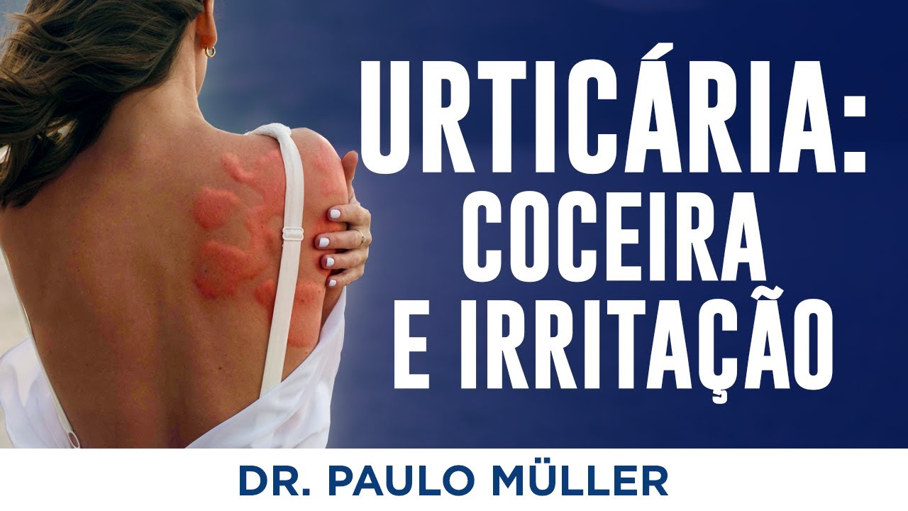 Urticaria: Coceira, Irritação e Vermelhidão na Pele – Dr. Paulo Müller Dermatologista