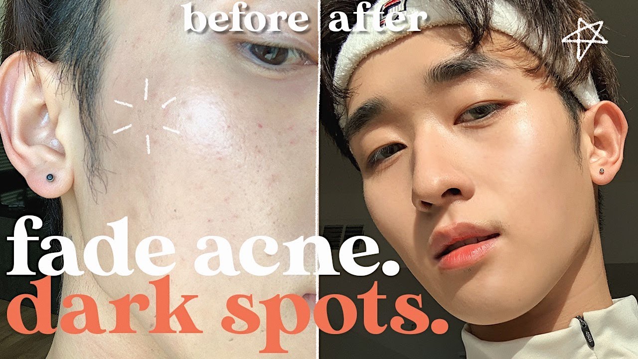 FADE dark spots FAST. skincare that actually works | IVAN LAM