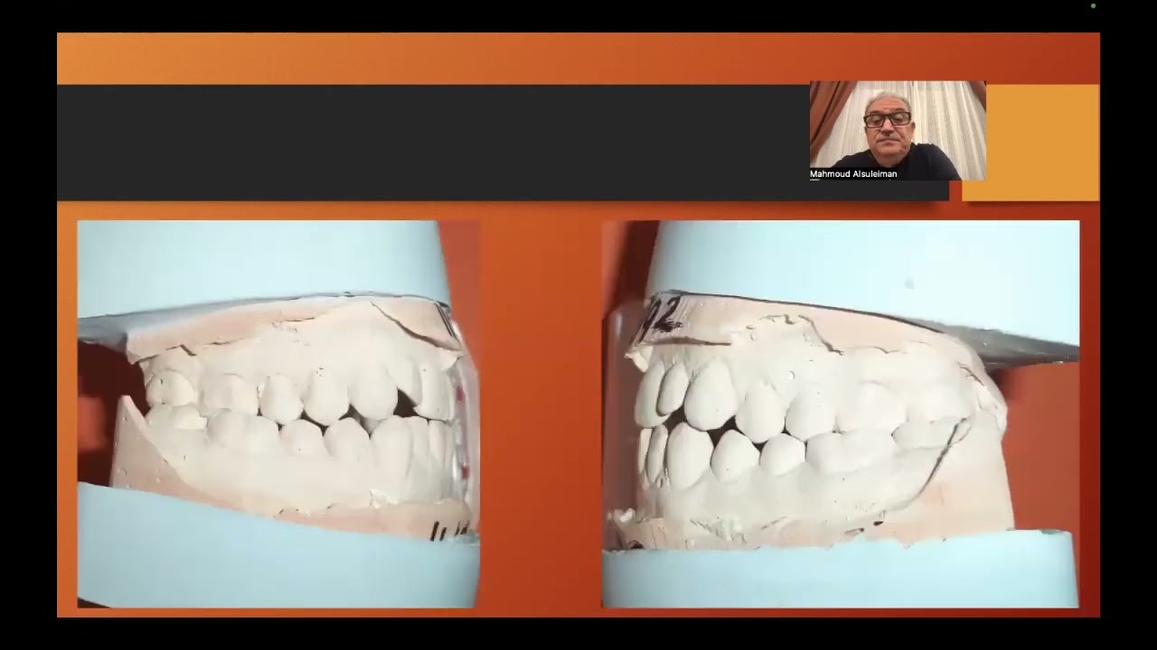 How to change orthodontics failure to success . Prof Mahmoud Alsleiman