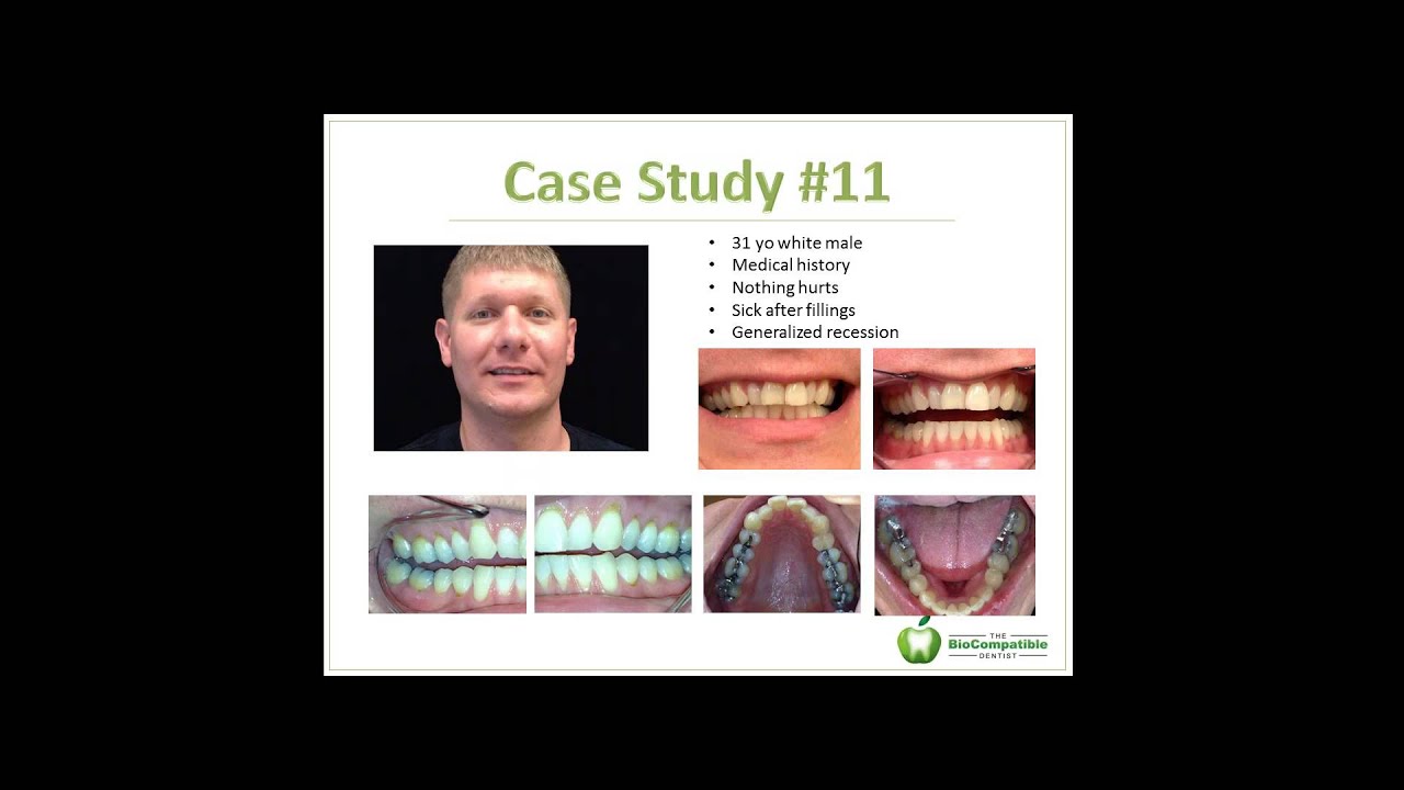Case Studies:  Double New Patient Value and have Your Patient Thank You for It!
