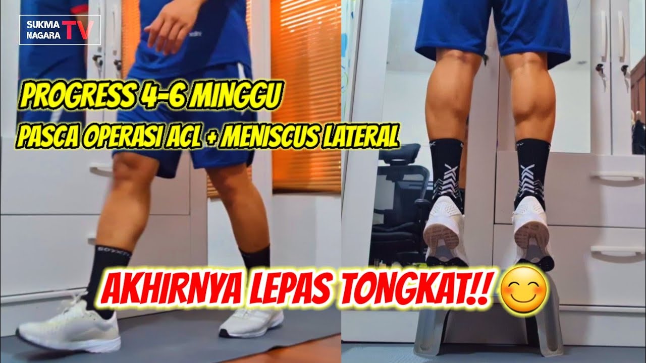 #87 6 MINGGU PASCA OPERASI ACL & MENISCUS LATERAL, AKHIRNYA LEPAS TONGKAT DAN BISA JALAN NORMAL 😊