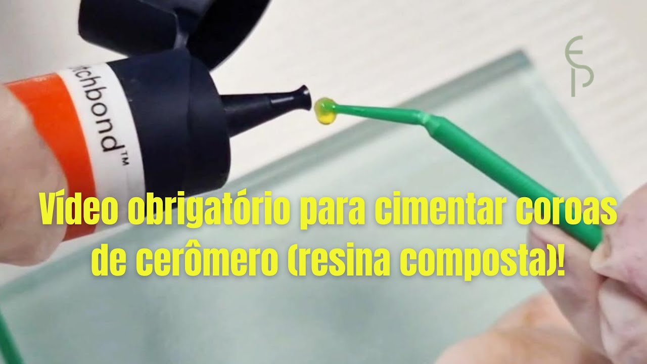 Vídeo OBRIGATÓRIO para cimentar coroas de cerômero (resina composta)!