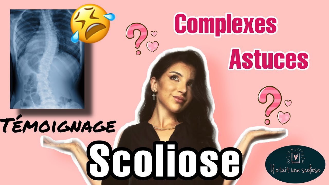 SCOLIOSE | Expérience, Complexes & Astuces