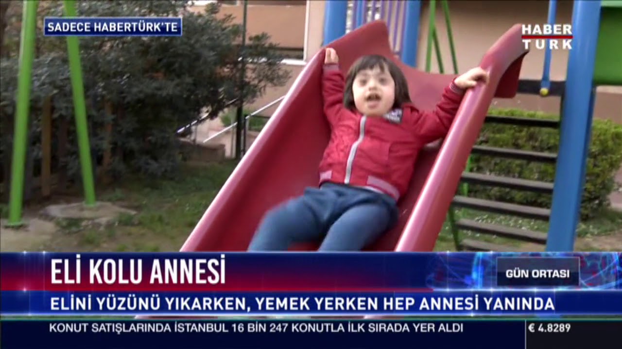 Down Sendromlu Ali, Annesinin Ellerinde Hayata Tutunuyor