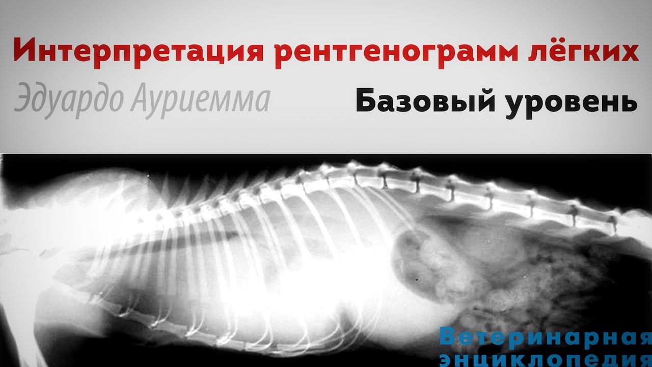 Интерпретация рентгенограмм лёгких