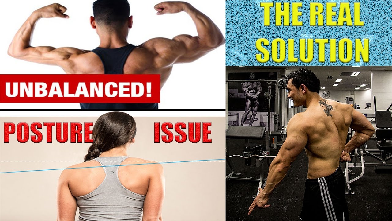 FIX MUSCLE IMBALANCE (बिना आपरेशन के) & POSTURAL DEFORMITY [HINDI]