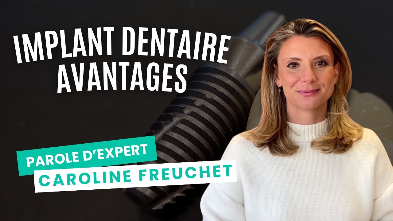 7 avantages de l'implant dentaire