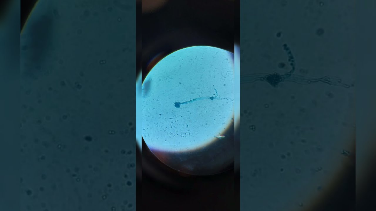 Aspergillus sp. under Lactophenol Cottonblue (LPCB) Staining
