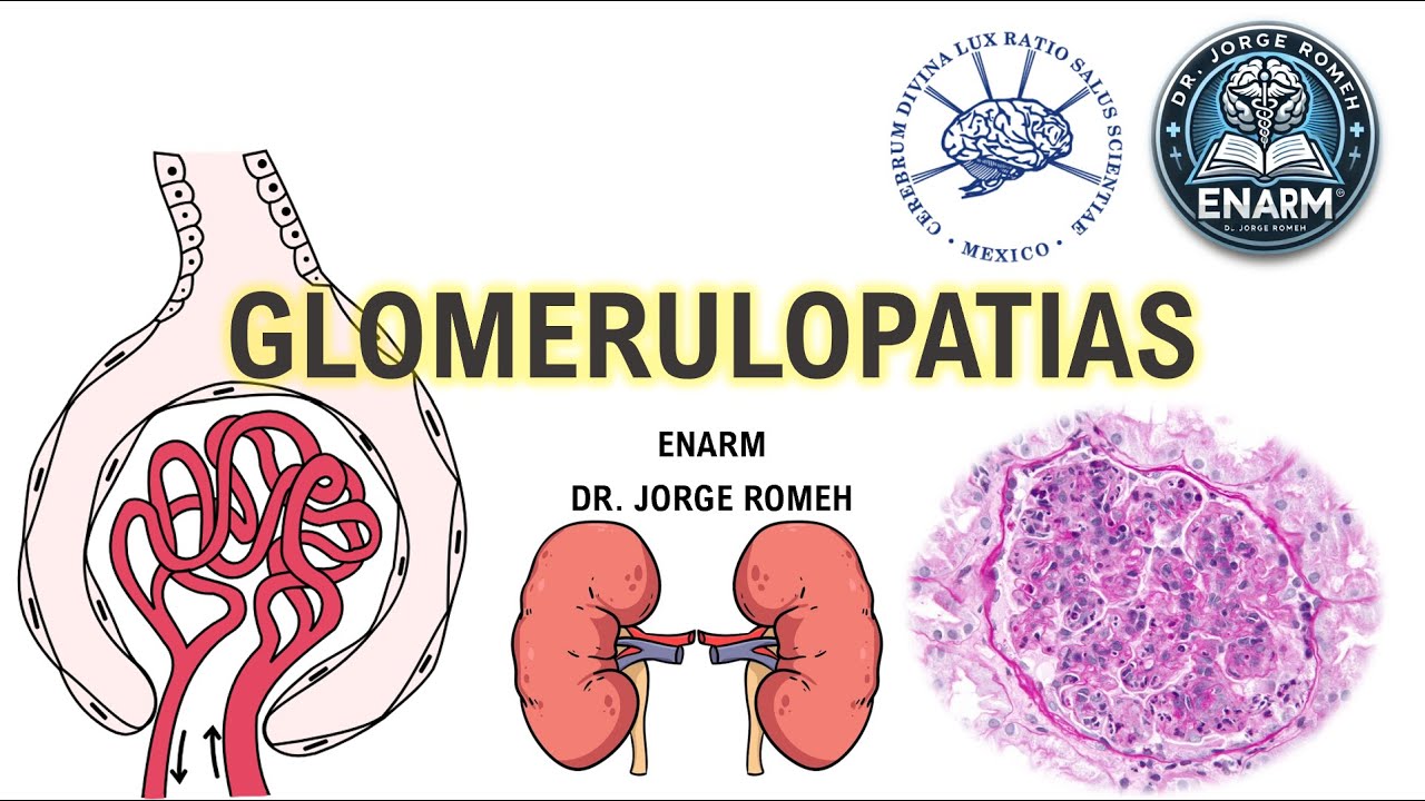 GLOMERULOPATIAS - ENARM - TODO LO QUE DEBES SABER